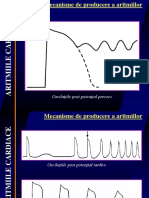 Aritmiile Cardiace - Mecanisme de Producere 2011