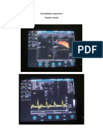 Estremidades Sueperiores Arterial Sonograma