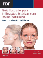Guia infiltração toxina botulinica