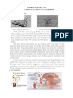 Lp Cva Trombosis