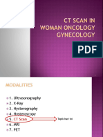 CT Scan in Woman Oncology Gynecology