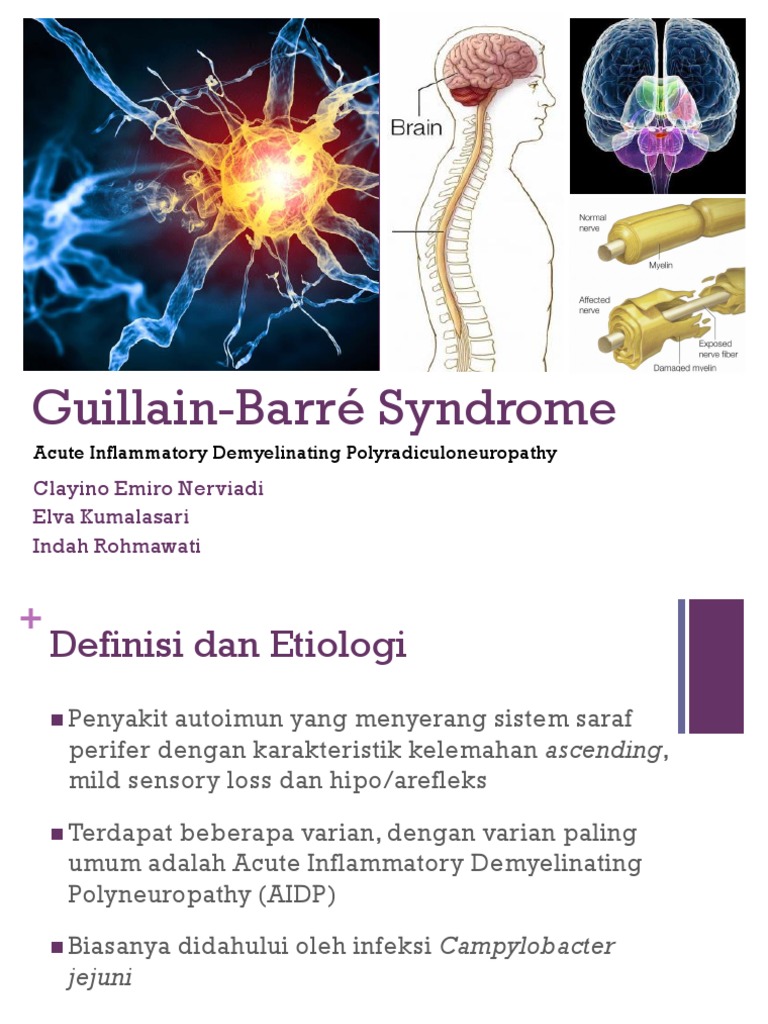 powerpoint presentation of guillain barre syndrome