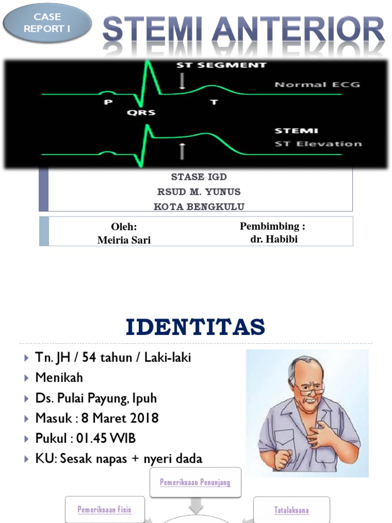STEMI | PDF