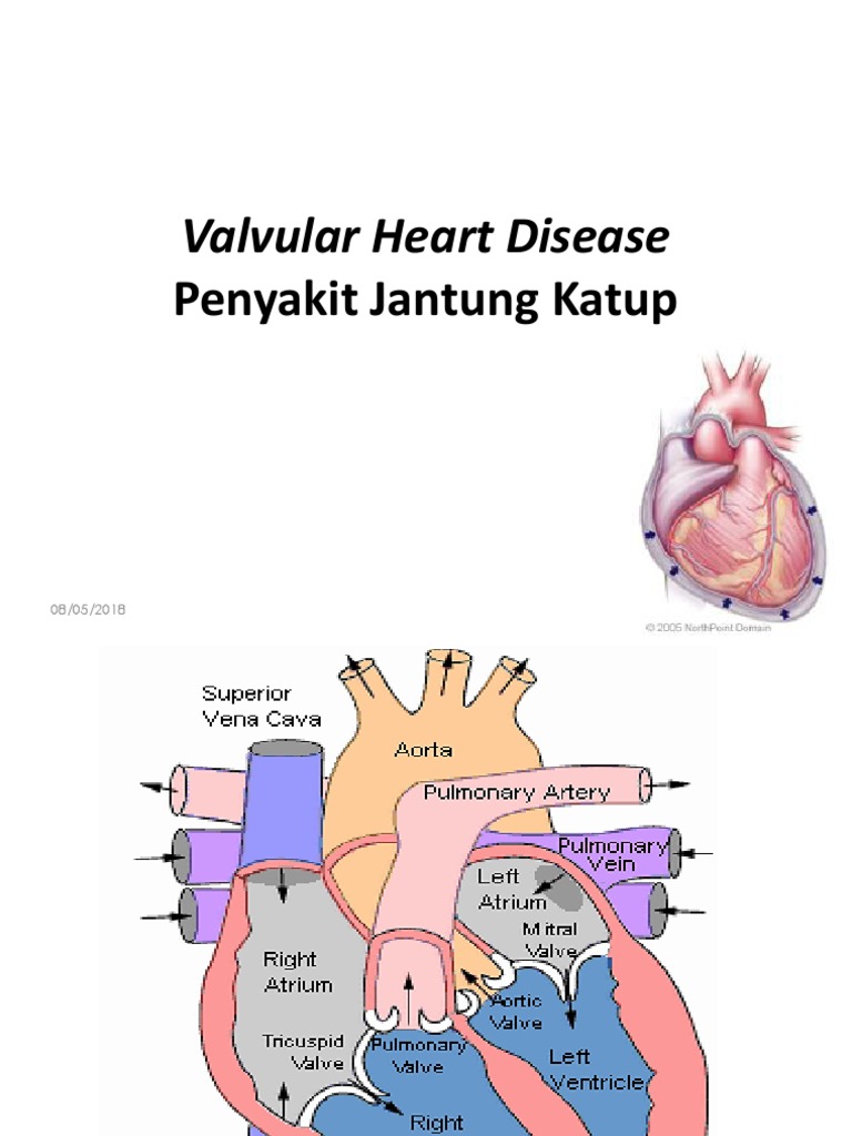 Valvular Heart Disease: Penyakit Jantung Katup | PDF | Travel | Wellness