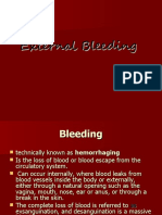 External Bleeding