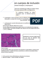 Miositis Con Cuerpos de Inclusión