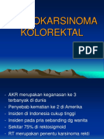 ADENOKARSINOMA