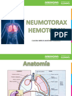 Diapositivas Neomotorax