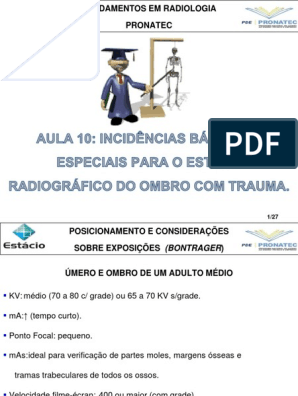 Aula 10 (Ombro Com Trauma), PDF, Osteoartrite