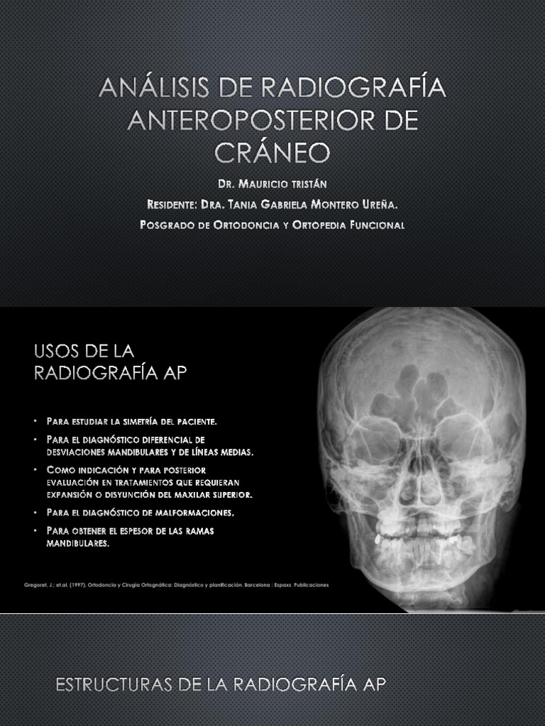 Análisis RX AP Ricketts | PDF | Ciencias de la Salud | Ortodoncia