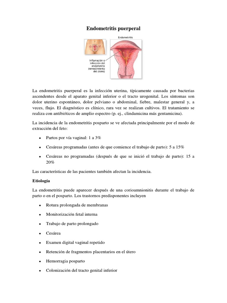 Endometritis puerperal Parto Antibióticos