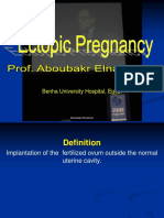 ectopicpregnancy imp 2 done.pdf