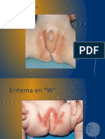 Dermatitis Por Contact