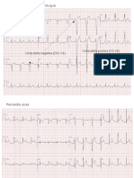 LP07ECG Exemple