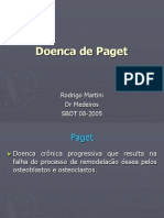 Doença de Paget: sinais, sintomas e tratamento