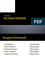 Kejang Demam