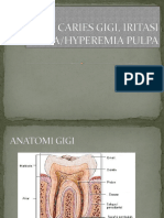 1.caries Gigi Dan Hyperemia Pulpa