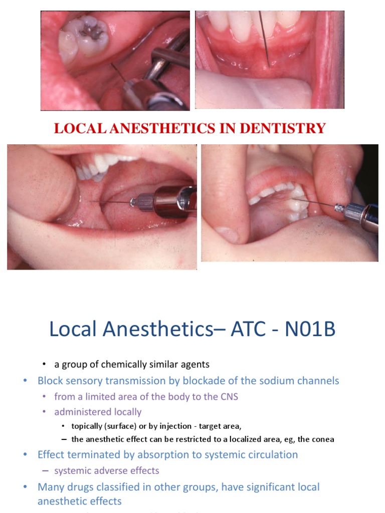 Local Anesthetics In Dentistry Medical Specialties Drugs