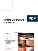 Clinical manifestation of trachoma.pptx