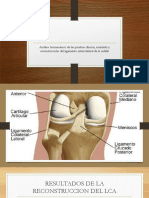 Reconstrucción Del Ligamento Cruzado Posterior