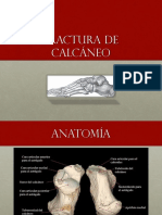 Fractura Calcáneo 13.05.16
