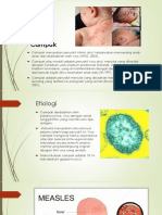 Imunisasi Campak Dan Meningitis