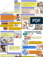 Cómo prevenir la enfermedad inflamatoria pélvica