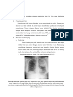 Diagnosis Tumor Pernafasan