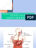 Cleft Lip & Palate: Nursing Management in Children With Congenital Disease