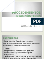Paracentesis