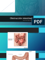 Obstrucción Intestinal 