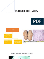 Tumores Fibroepiteliales