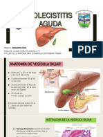 Colecistitis Aguda