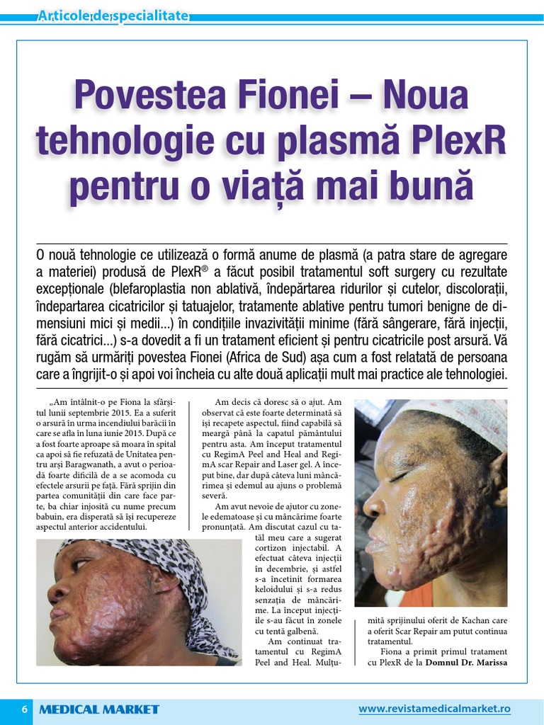 Plex R | PDF