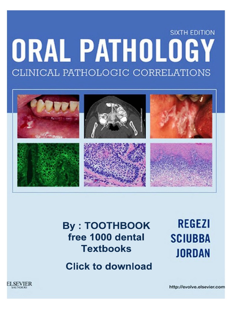 Oral Pathology - Clinical Pathologic Correlations - 6th - Ed | PDF ...