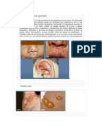 Dermatitis Bacterianas