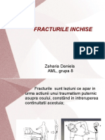 Fracturi Inchise