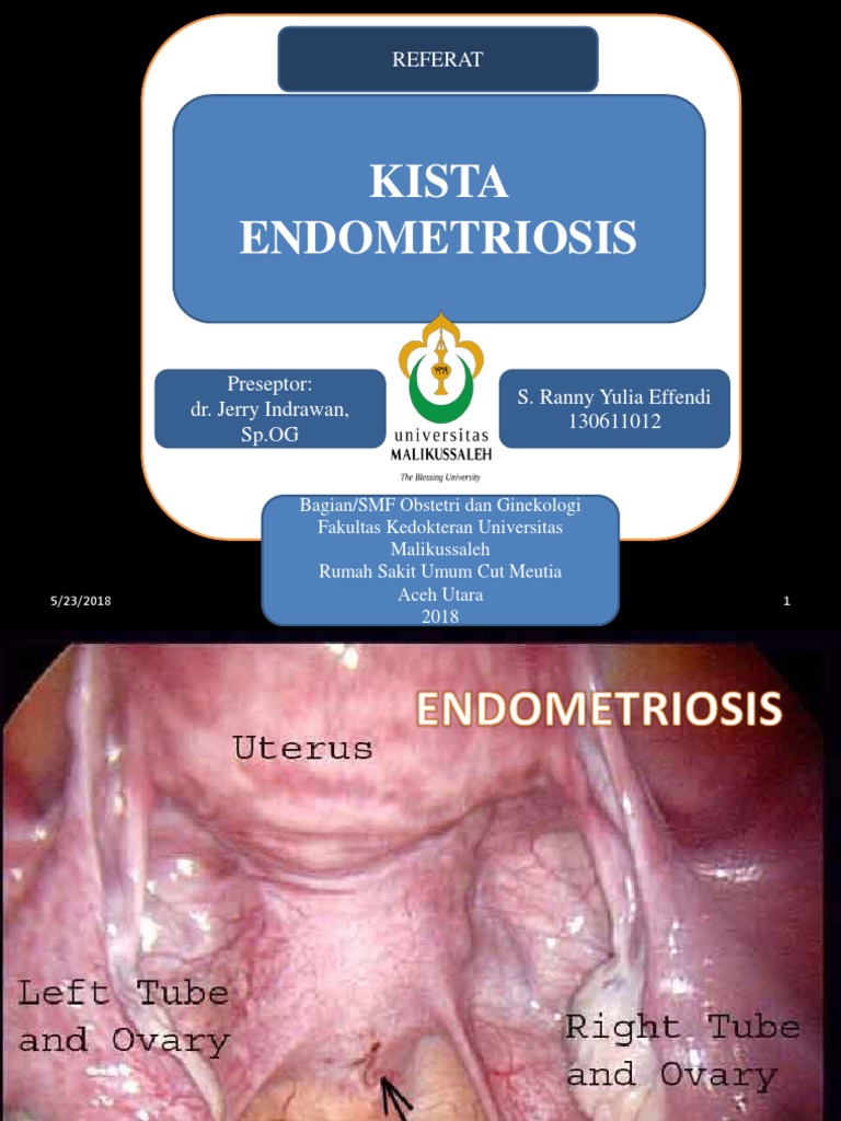 Ppt Endometriosis Clinical Medicine Women's Health