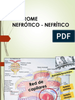 Caso Clínico Sd Nefrotico Nefrítico y Falla Renal Aguda