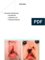 Hidung: - Anatomi - Fisiologi - Kelainan Kongenital - Nasobifida - Dermoid Cyst - Atresia/Stenosis