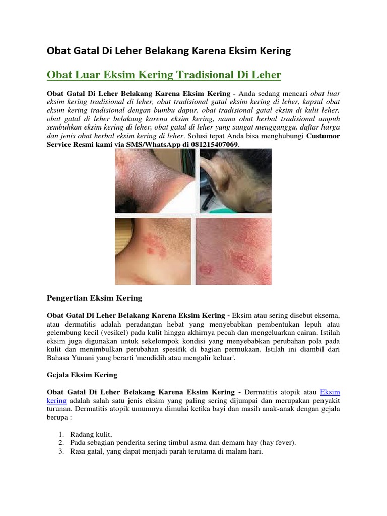 Obat Gatal Di Leher Belakang Karena Eksim Kering
