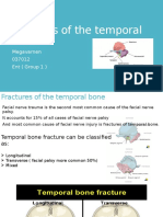 Fractures of the Temporal Bone