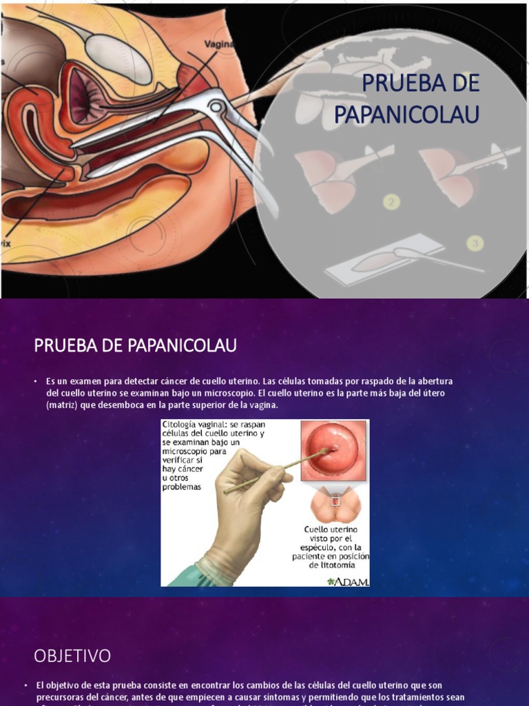 PRUEBA DE PAPANICOLAOU intelligence overview