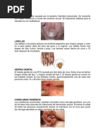 ENFERMEDADES VENEREAS