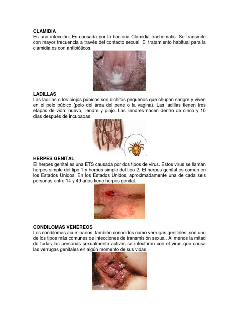 Enfermedades Venereas PDF Infecção sexualmente transmissível Herpes simples