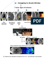 Brain Ischemia - Imaging in Acute Stroke