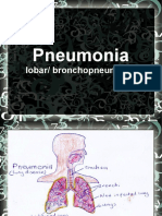 Pneumonia: Lobar/ Bronchopneumonia