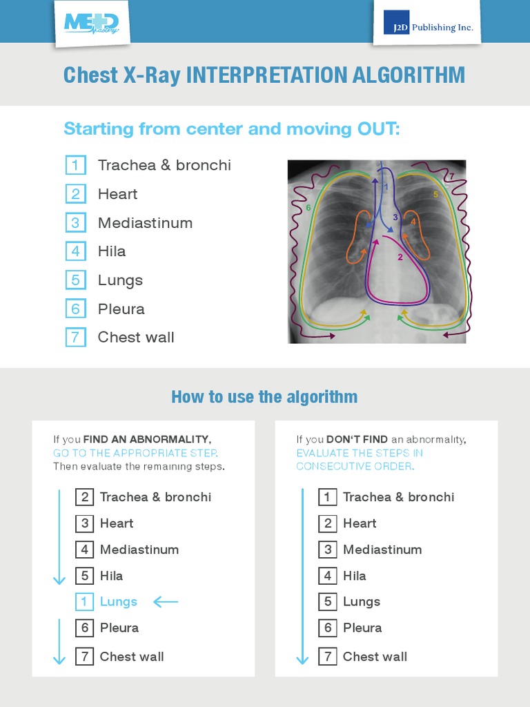 Chest X Ray Diagnostic Algorithm PDF Thorax Lung