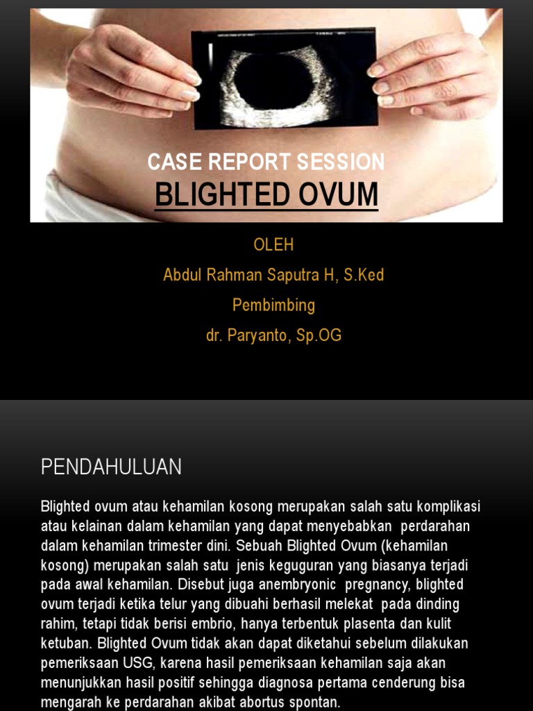 Blighted Ovum | PDF