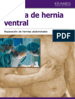 Cirugia de Hernia Ventral